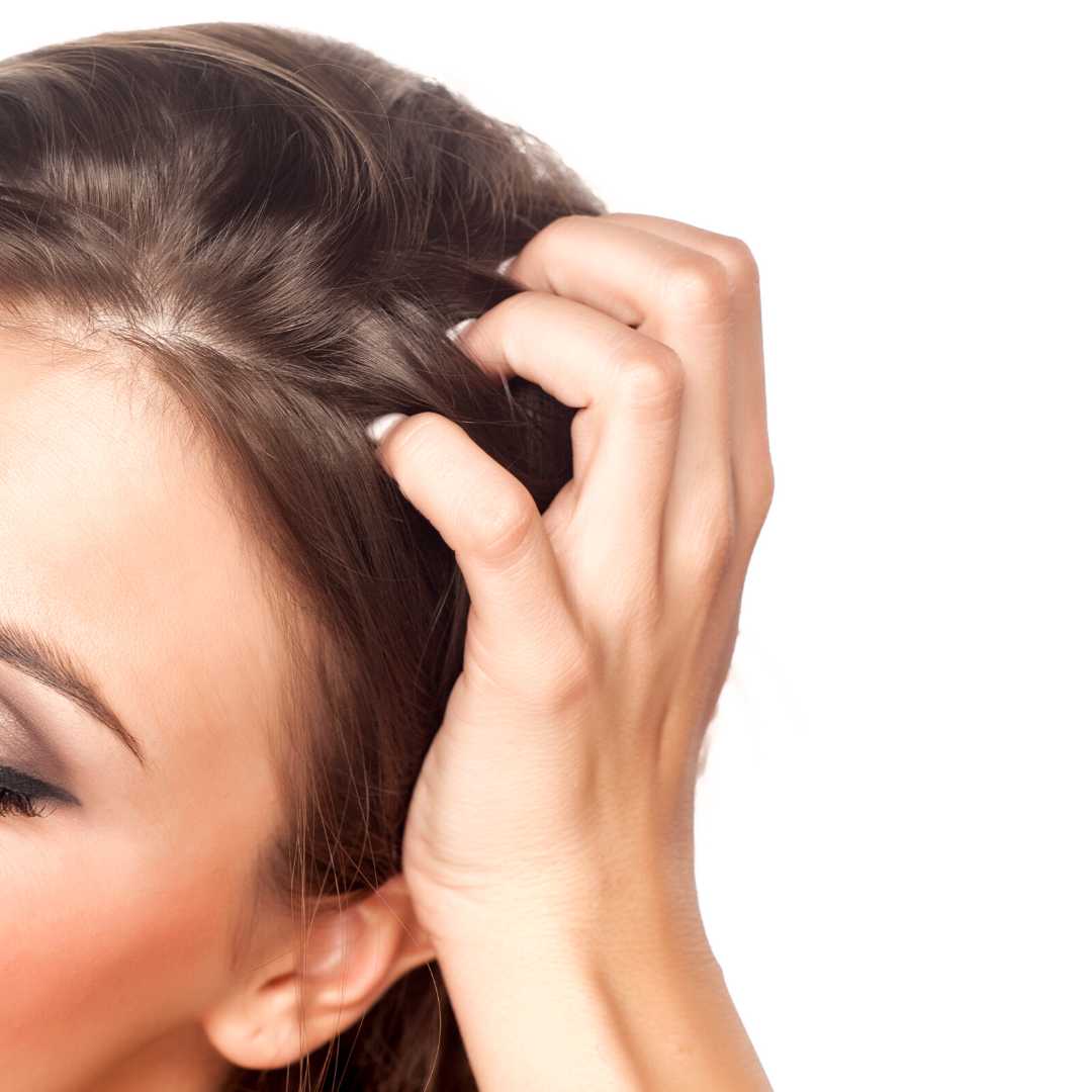 Femme qui se gratte les cheveux - LAO - Cheveux au naturel - Soins lavants 100% d'origine naturelle - Shampoings sans sulfates ni silicones