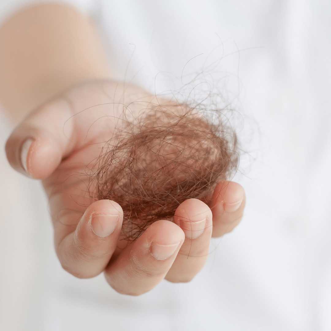 Chute de cheveux : alopécie ou calvitie ? LAO Care